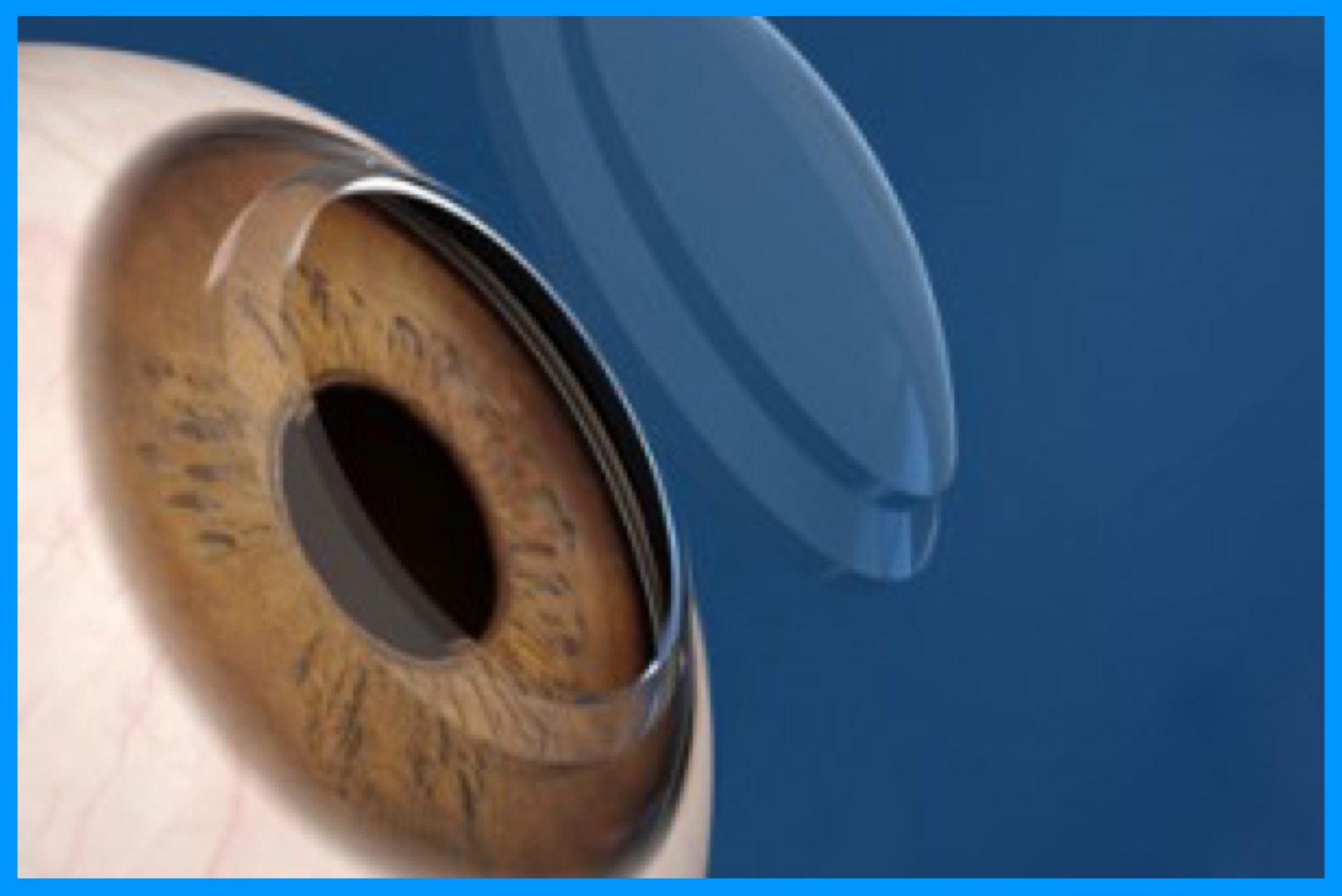 simulazione immagine cornea bioingegnerizzata